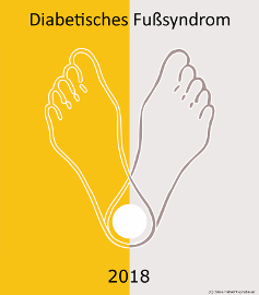 diabetisches Fußsyndrom 2018